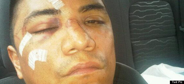 Actor colombiano brutalmente golpeado por hacer de villano (FOTOS GRÁFICAS)