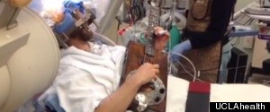 WATCH: The First Live-Vined Brain Surgery