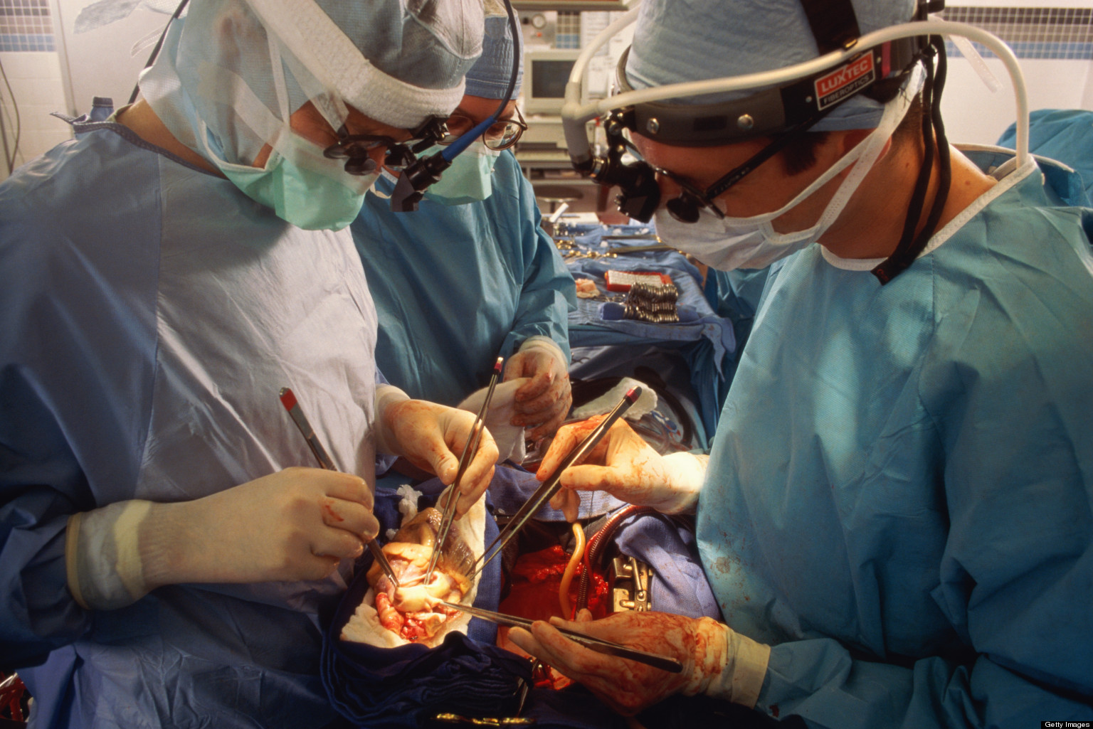 The Frightening Truth About Heart Transplants HuffPost UK