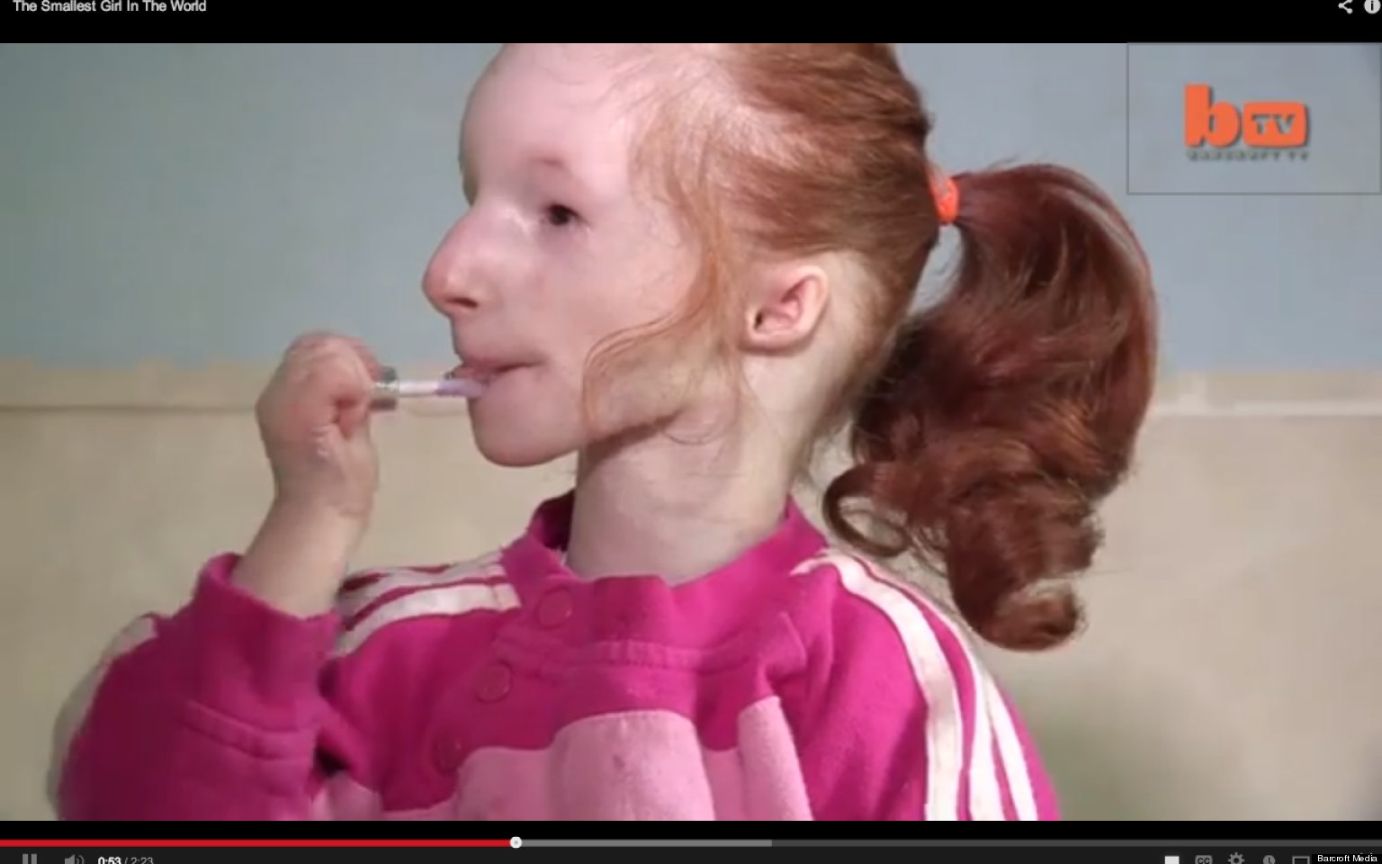 The Tiniest Girl In The World Charlotte Garside Who Has World s