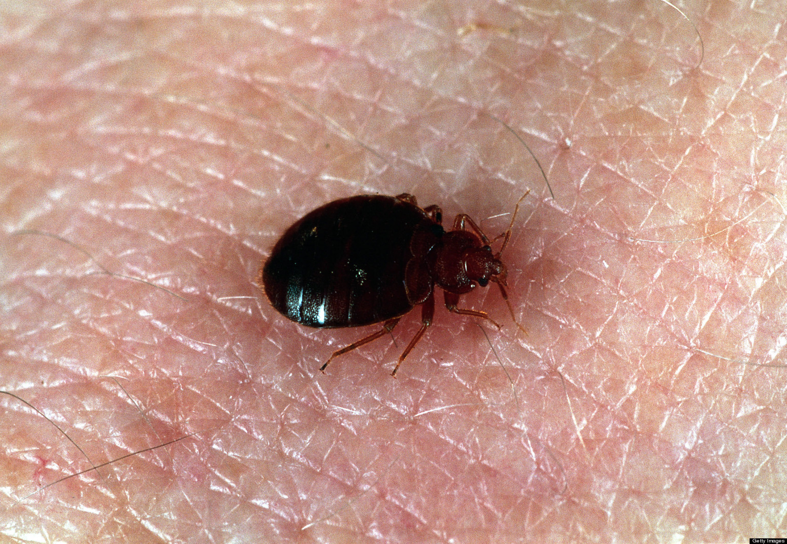 Bed Bug Lawsuit Bed Bugs Bed Bug Lawsuit Bed Bugs