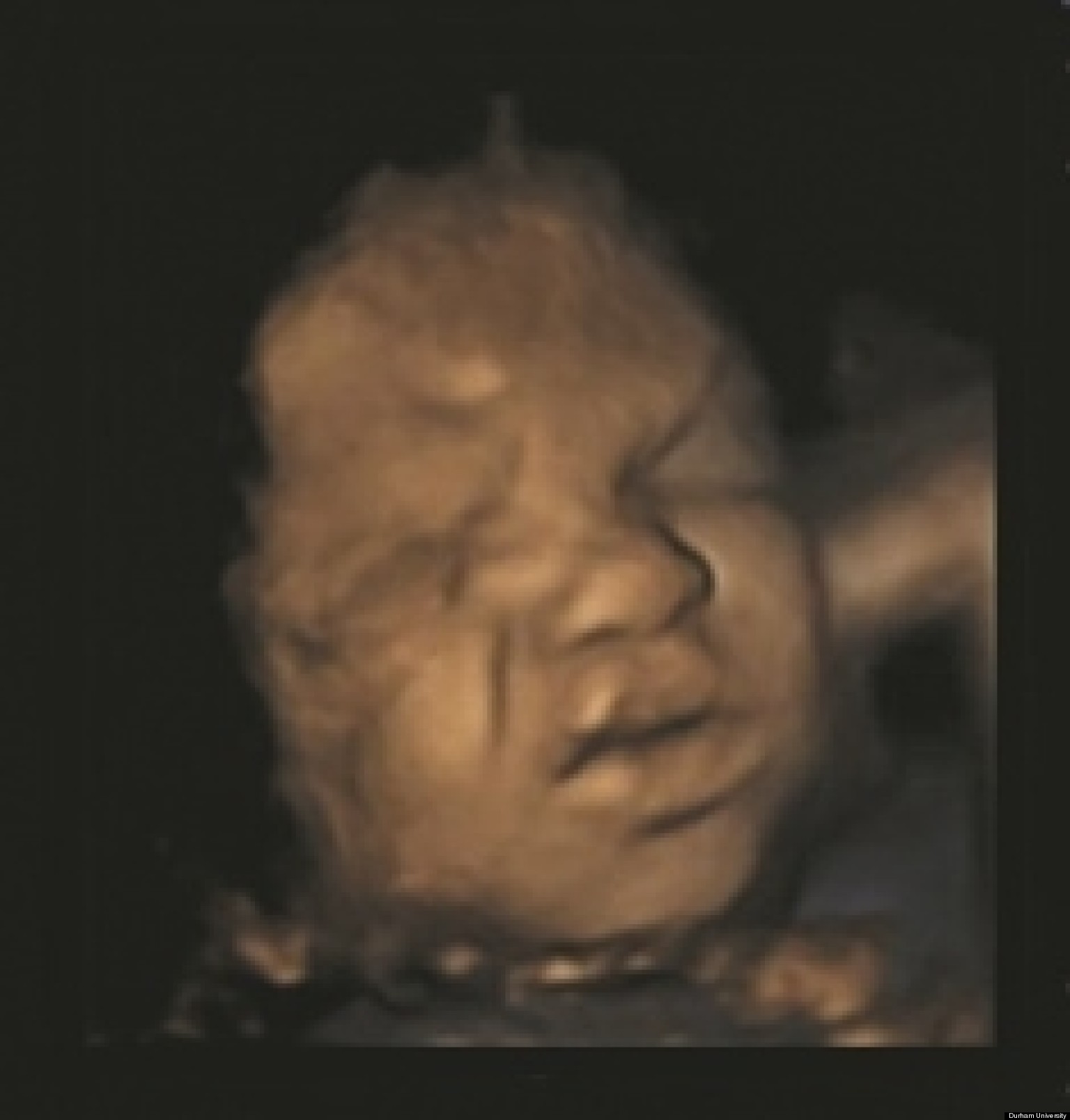 Babies In Womb Make Faces & Complex Expressions, Study Shows (PHOTOS