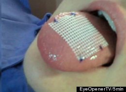 Tongue Patch