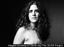 Facebook Revises Guidelines On Mastectomy Photos After Breast Cancer Patient's Petition (PICTURES)