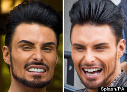 Rylan Debuts New Smile