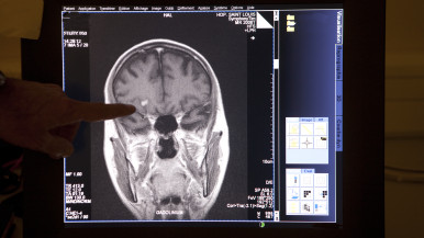 Brain Scan