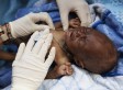 Through PEPFAR Support, One Million Babies Born HIV-free