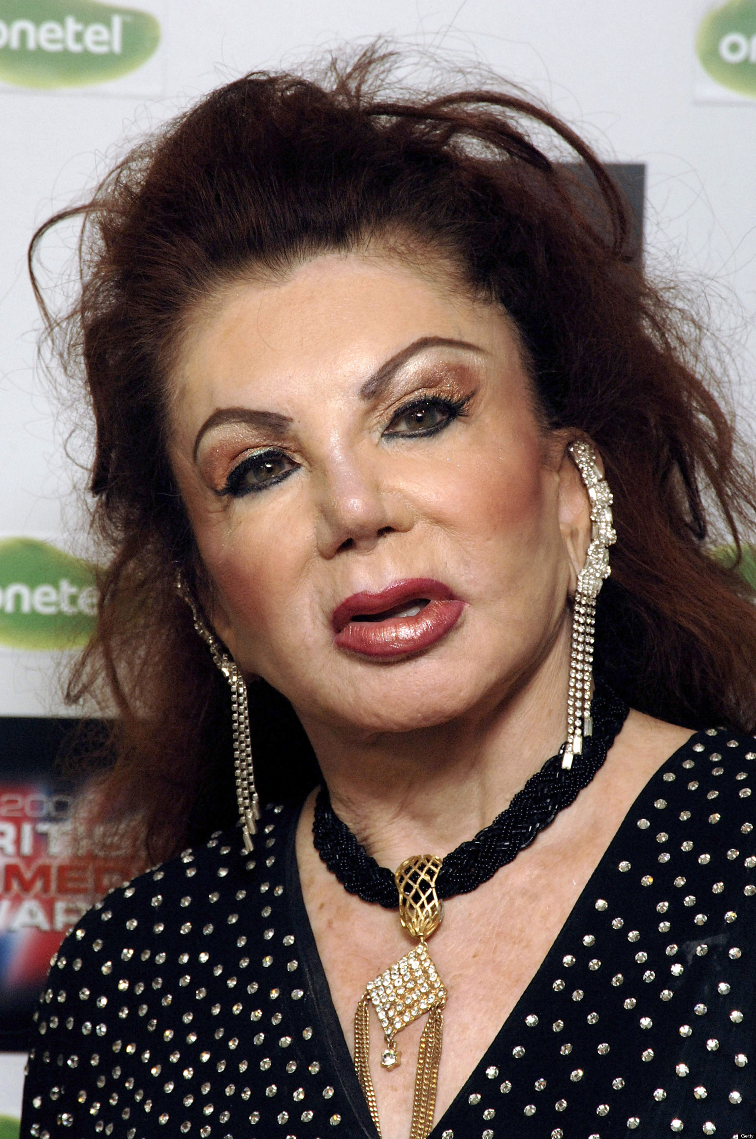 Jackie Stallone Plastic Surgery I Look Like A Chipmunk