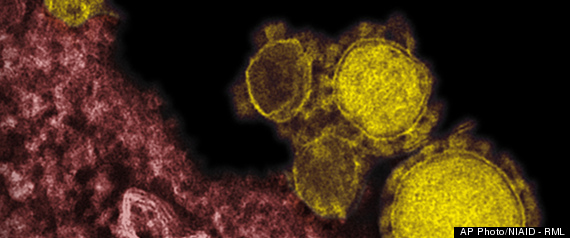 MERS VIRUS: MYSTERIOUS NEW RESPIRATORY VIRUS SPREADS EASILY, APPEARS DEADLIER THAN SARS R-MERS-VIRUS-large570