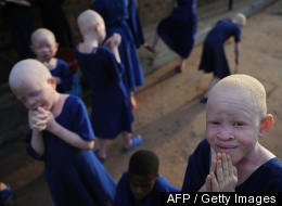 Albino Kenyan