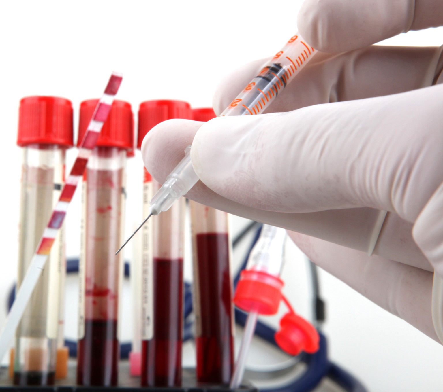 Will A Normal Blood Test Show Stds