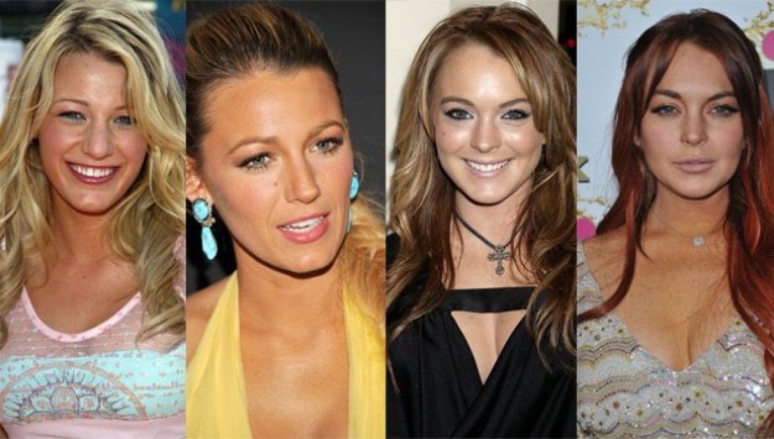Celebrity Plastic Surgery Have These Stars Had Work Done?