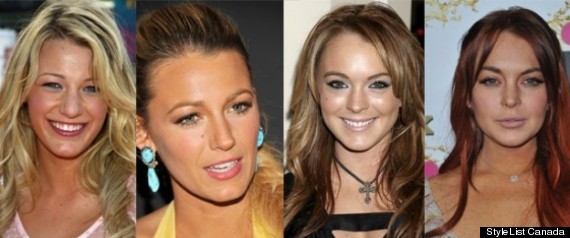 Celebrities Who Have Had Plastic Surgery