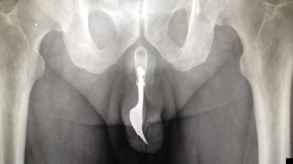 Penis X Rays 25