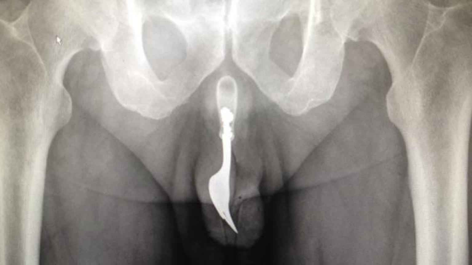 Penis Xrays 3