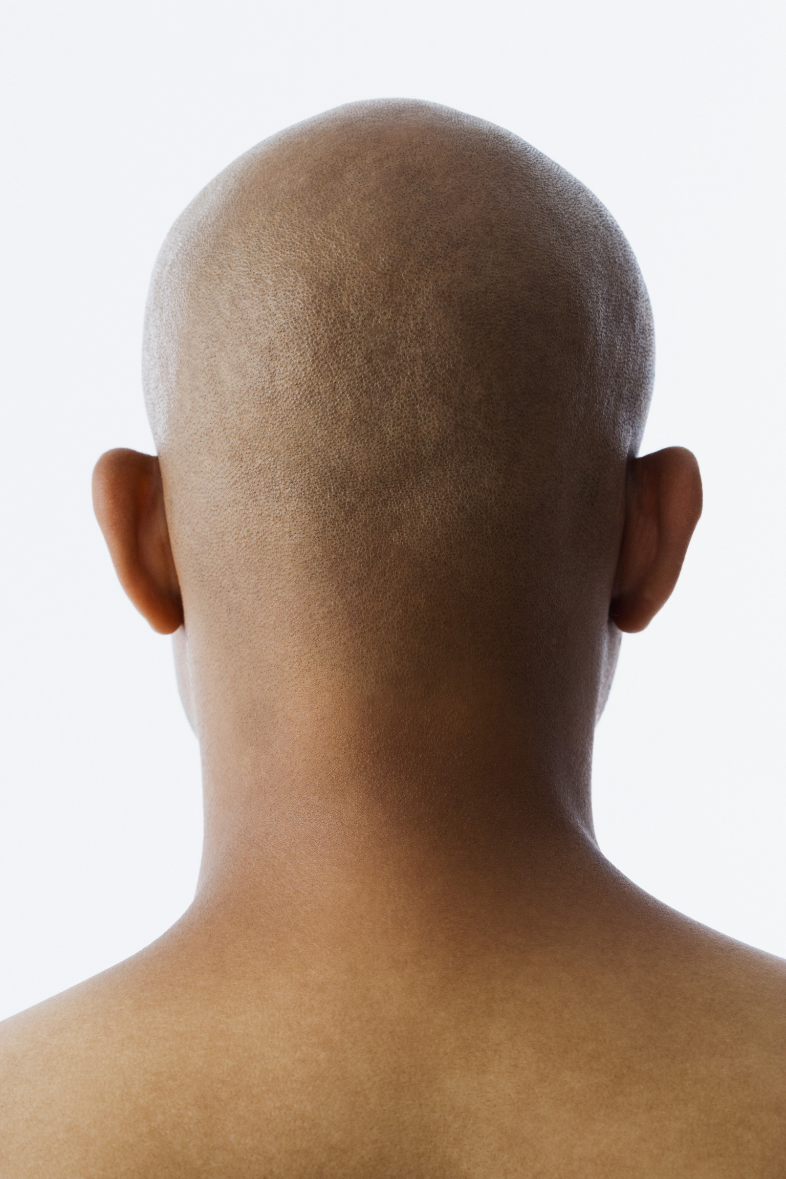 early-balding-may-raise-risk-of-als-study-finds-huffpost