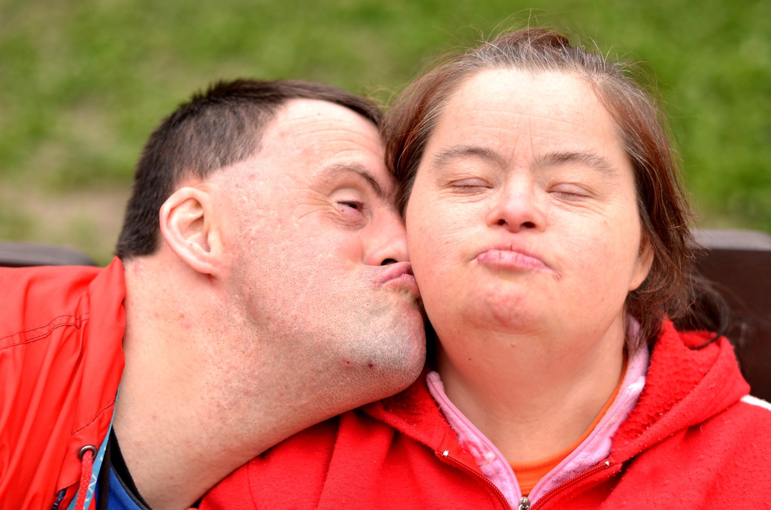 down-syndrome-treatment-study-shows-experimental-drug-reverses
