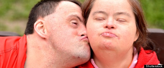 Down syndrome dating show