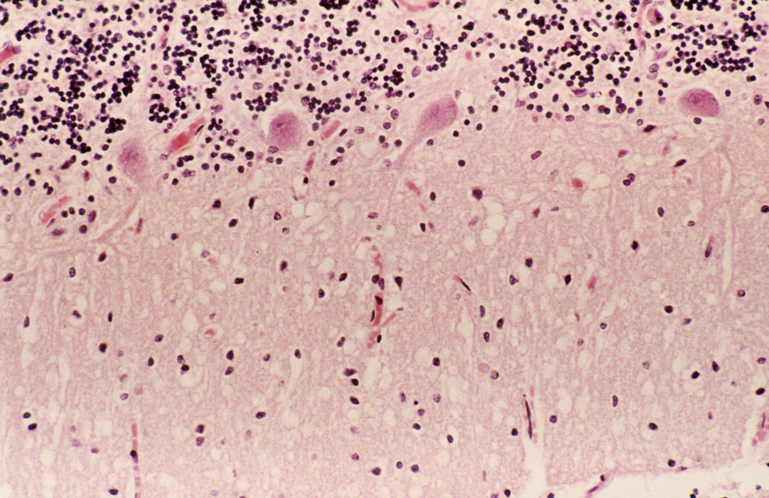 2 Patients At VA Hospital In Connecticut May Have Also Been Exposed To