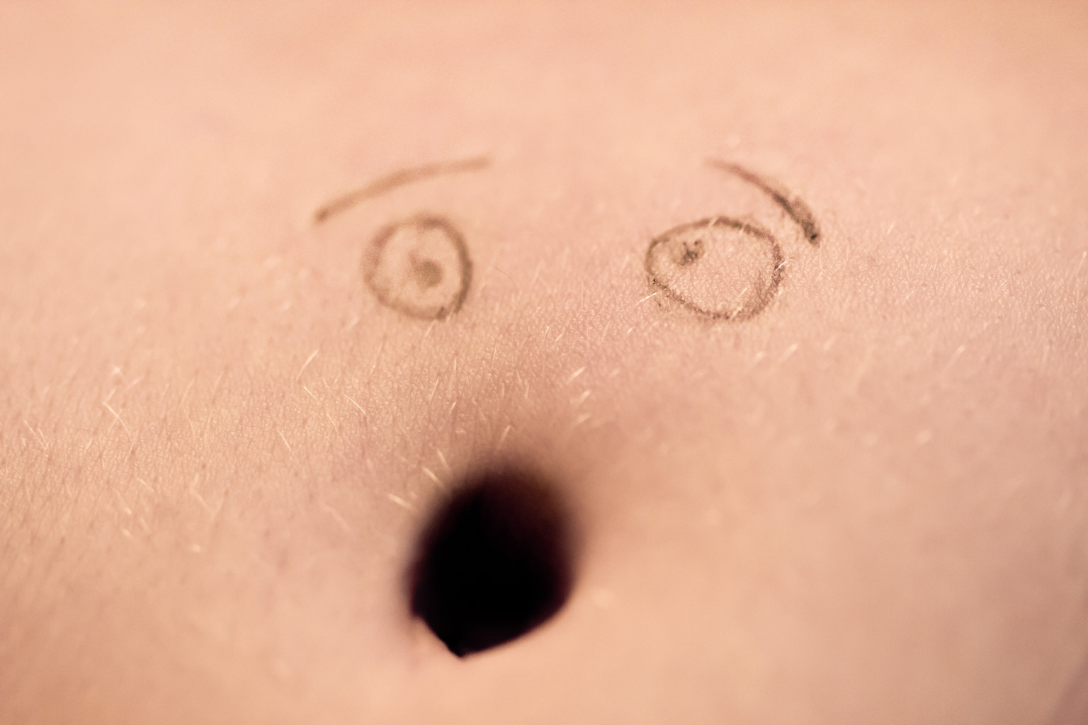 How can an outie belly button be turned into an innie?