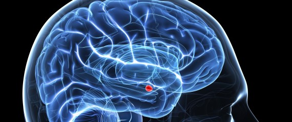 Brain Surgery To Remove Amygdala Leads 