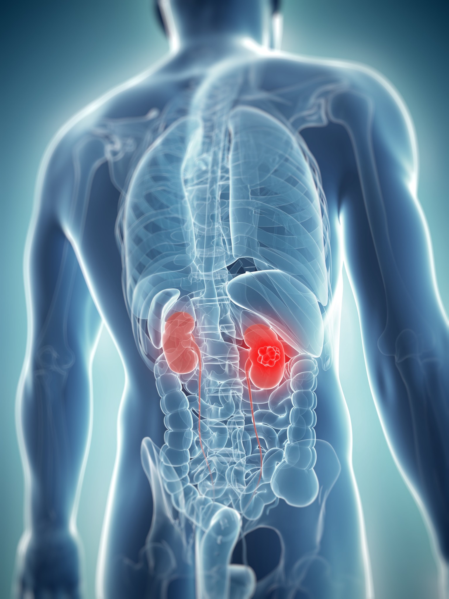 What Does Renal Mean In Medical Terms