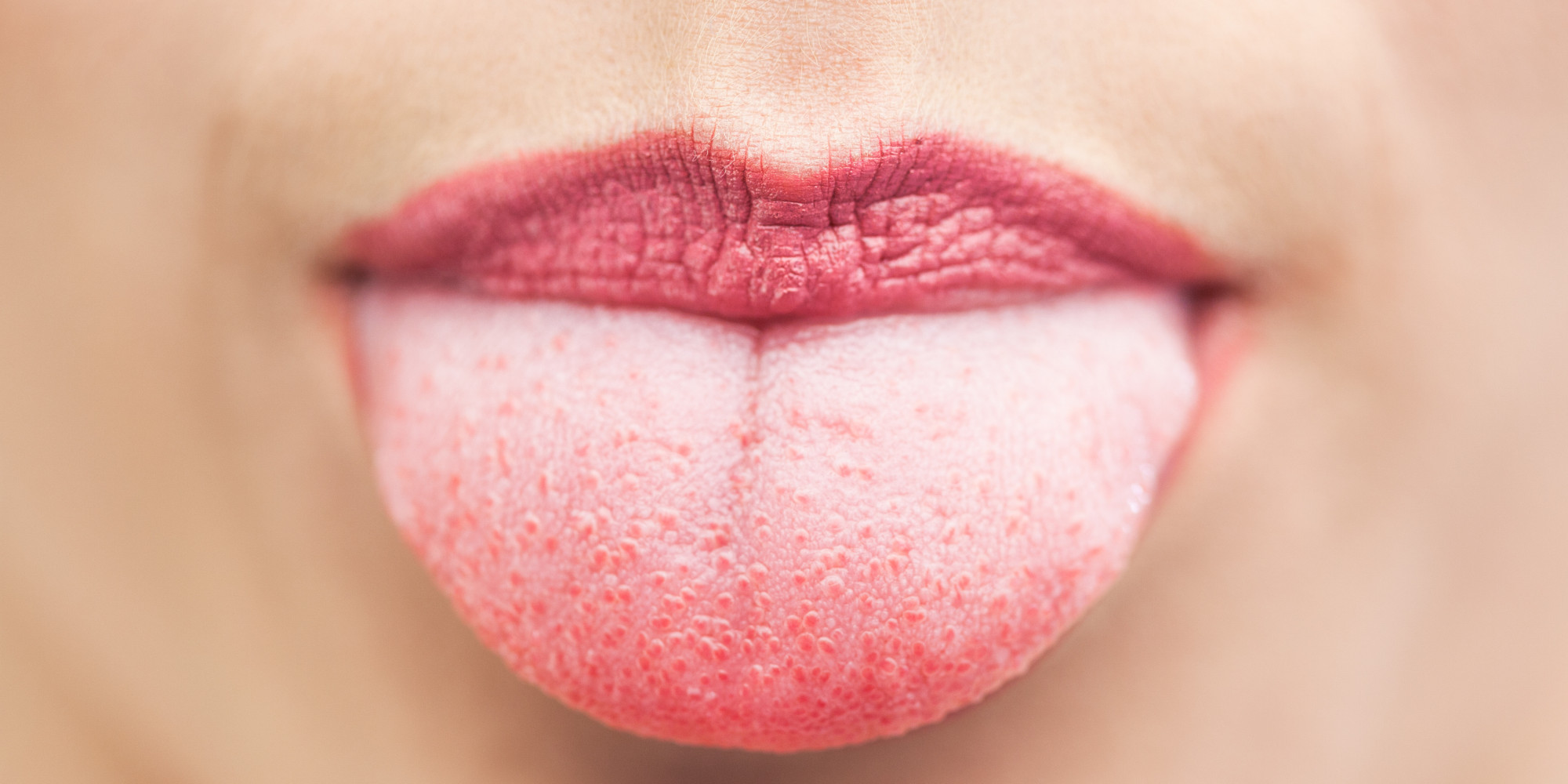 Dr Oz What The Color Of Your Tongue Can Tell You About Your Health