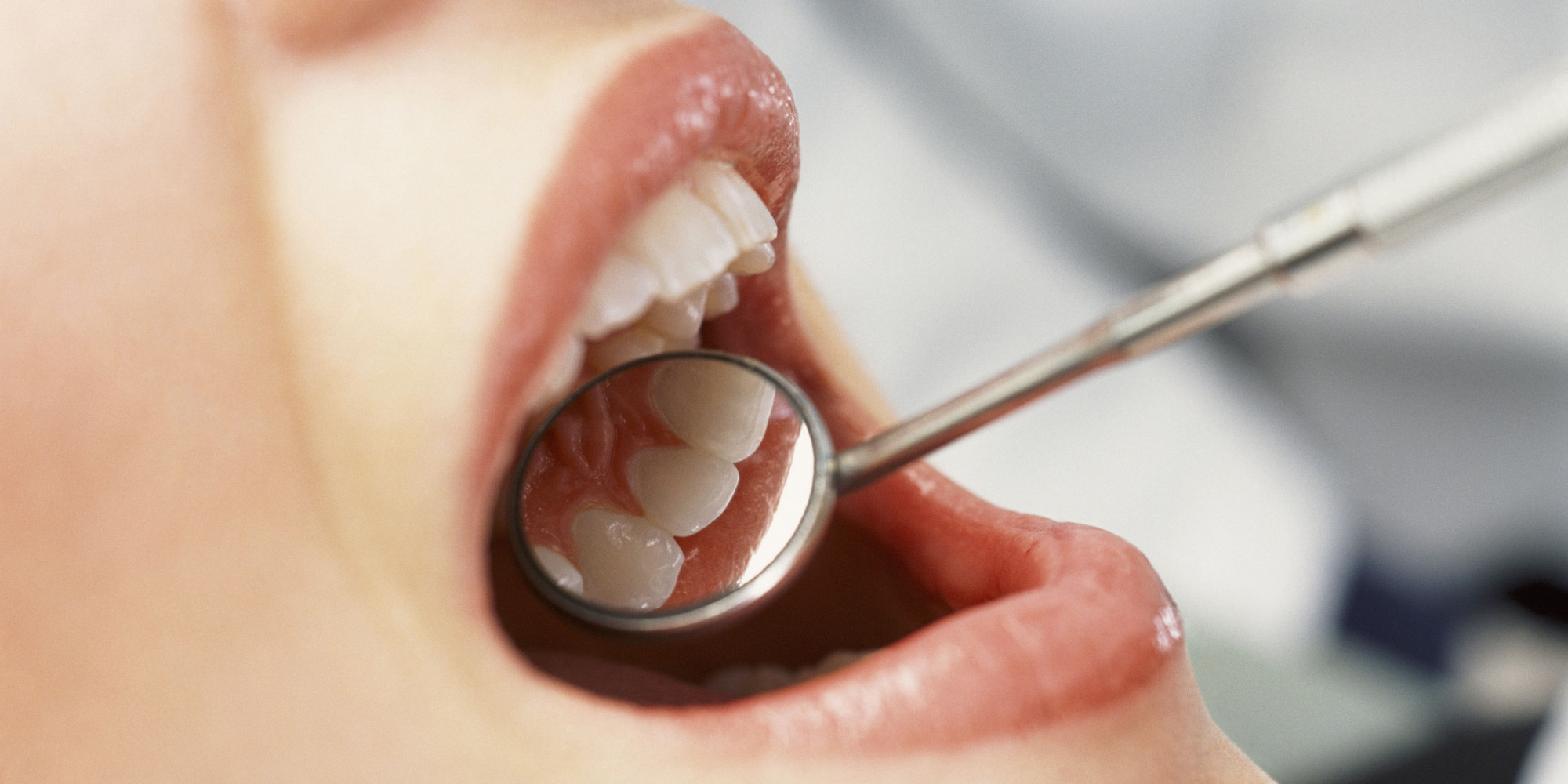 A Dentist's View on Tackling the National Dental Health Crisis | HuffPost