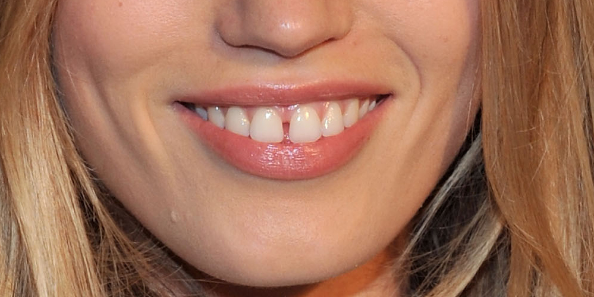 gap teeth models toothed between braces space tooth gaps comes making trend