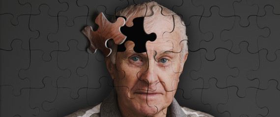 alzheimers early detection