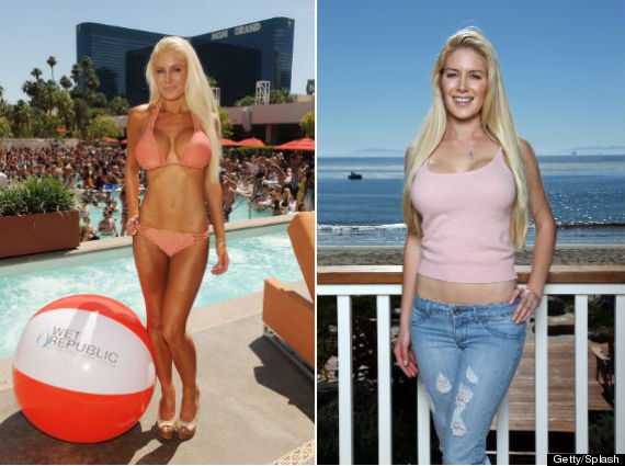 Entertainment News: Heidi Montag Reveals C-Cup Breasts After