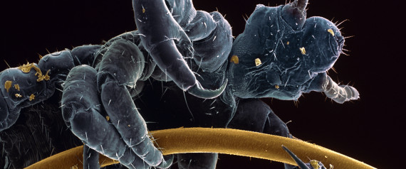 lice human evolution