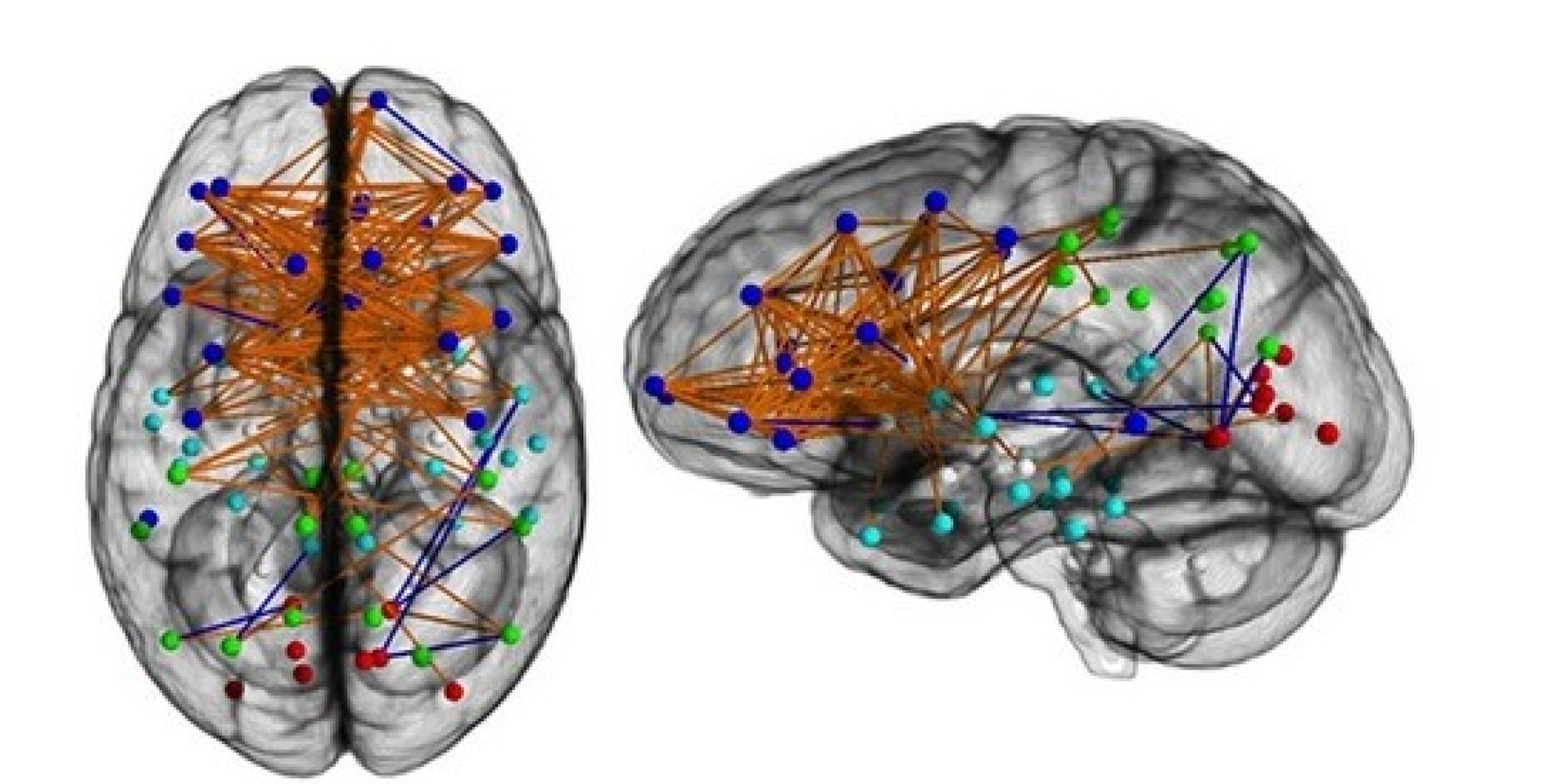 Male Female Brains Are Wired Very Differently Scans Show Huffpost