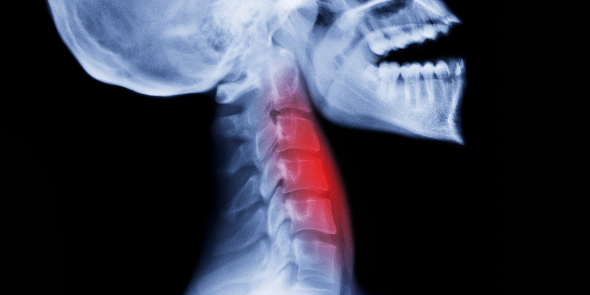 COPD Drug Breo Is Effective For Asthma Patients In Trial HuffPost