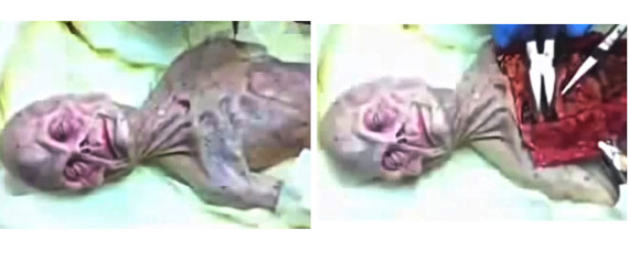 russia 1969 ufo crash alien autopsy