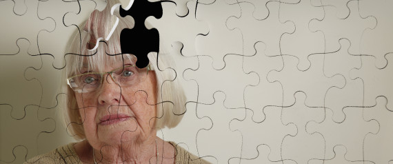 Alzheimer's treatment