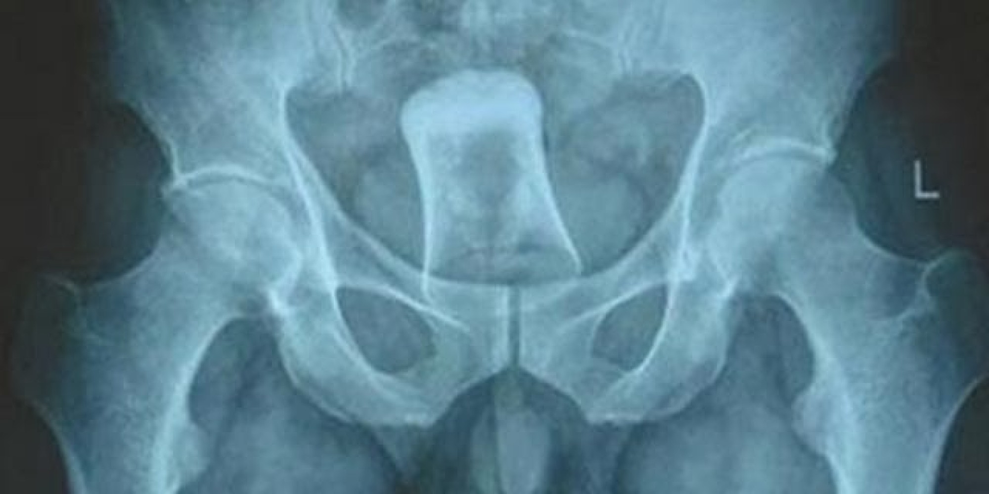 X Ray Cock Inside Pussy Cumception