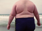 Obese Children May Have Higher Levels Of Stress Hormone