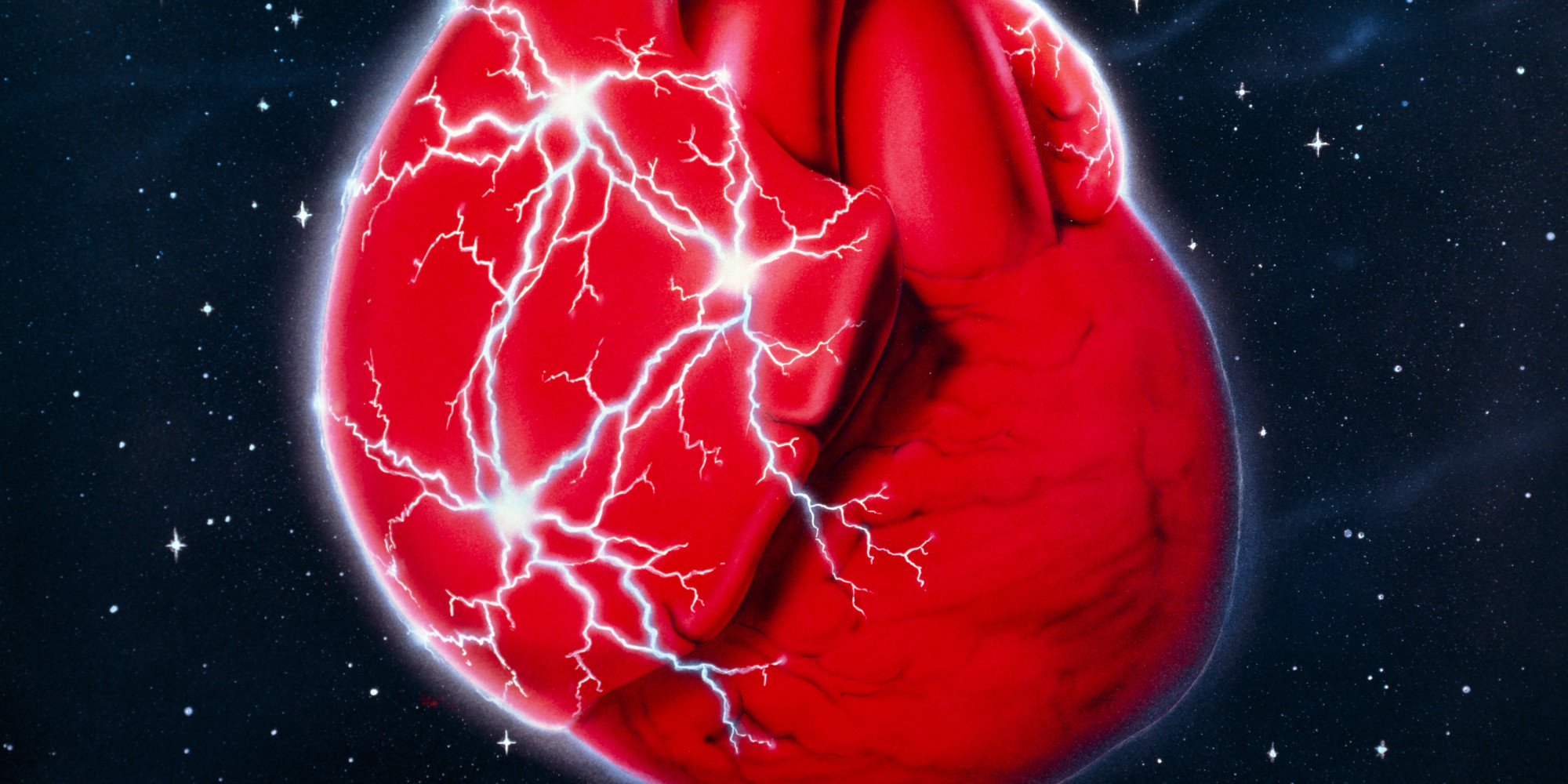 Atrial Fibrillation Prevalence Has Increased Over The Last 30 Years 
