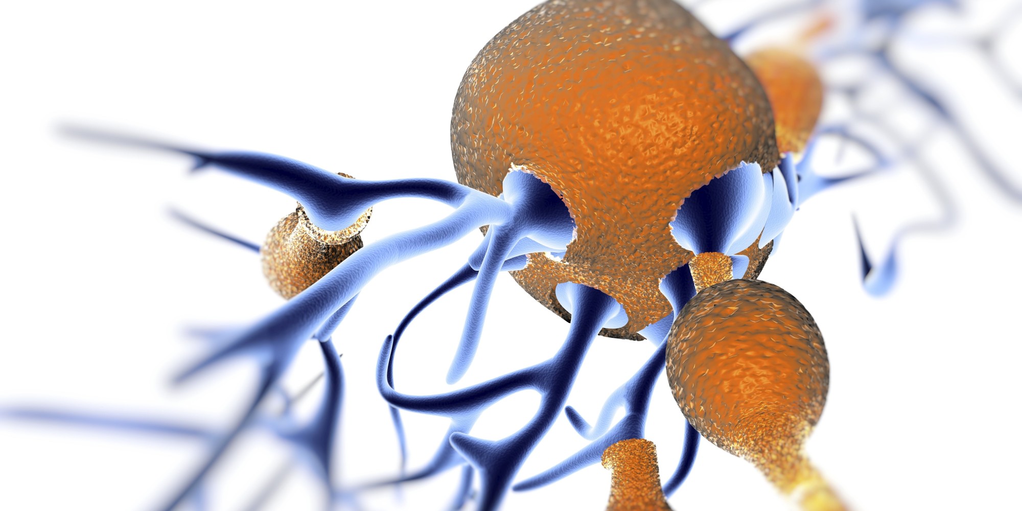 Cholesterol Could Affect Plaque Buildup In The Brain, Study Finds