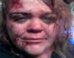 Susann Stacy Posts Bloody