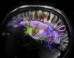 Ultrasound May Boost Brain's