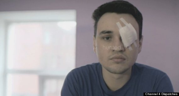 Violence Against Gay People In Russia Laid Bare In Shocking C4 Dispatches Documentary Hunted