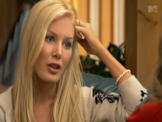 heidi montag plastic surgery. Heidi Montag Plastic Surgery