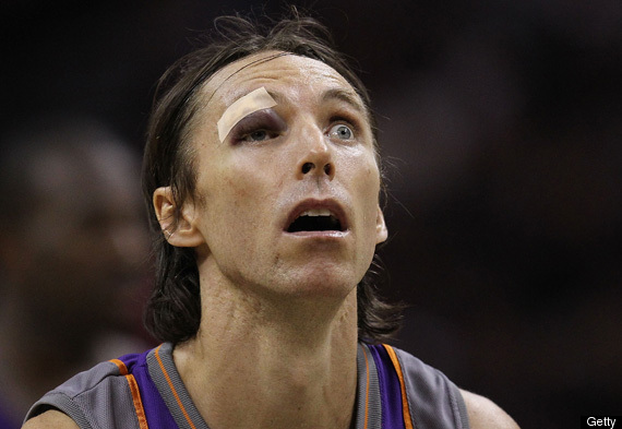 Steve Nash Elbowed In Face, Keeps Playing With Eye Swollen Shut (PHOTOS