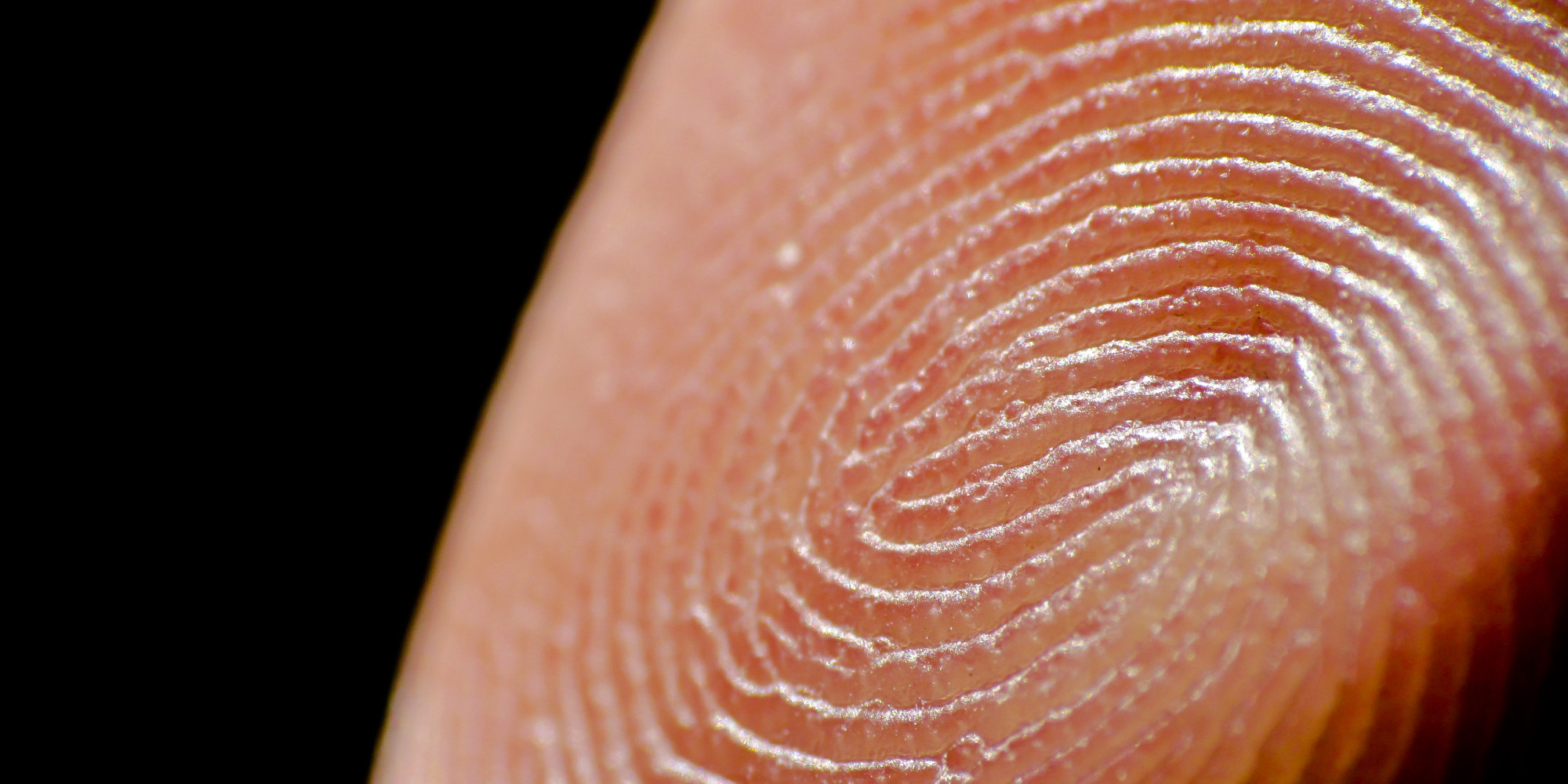 why-some-people-don-t-have-fingerprints-huffpost