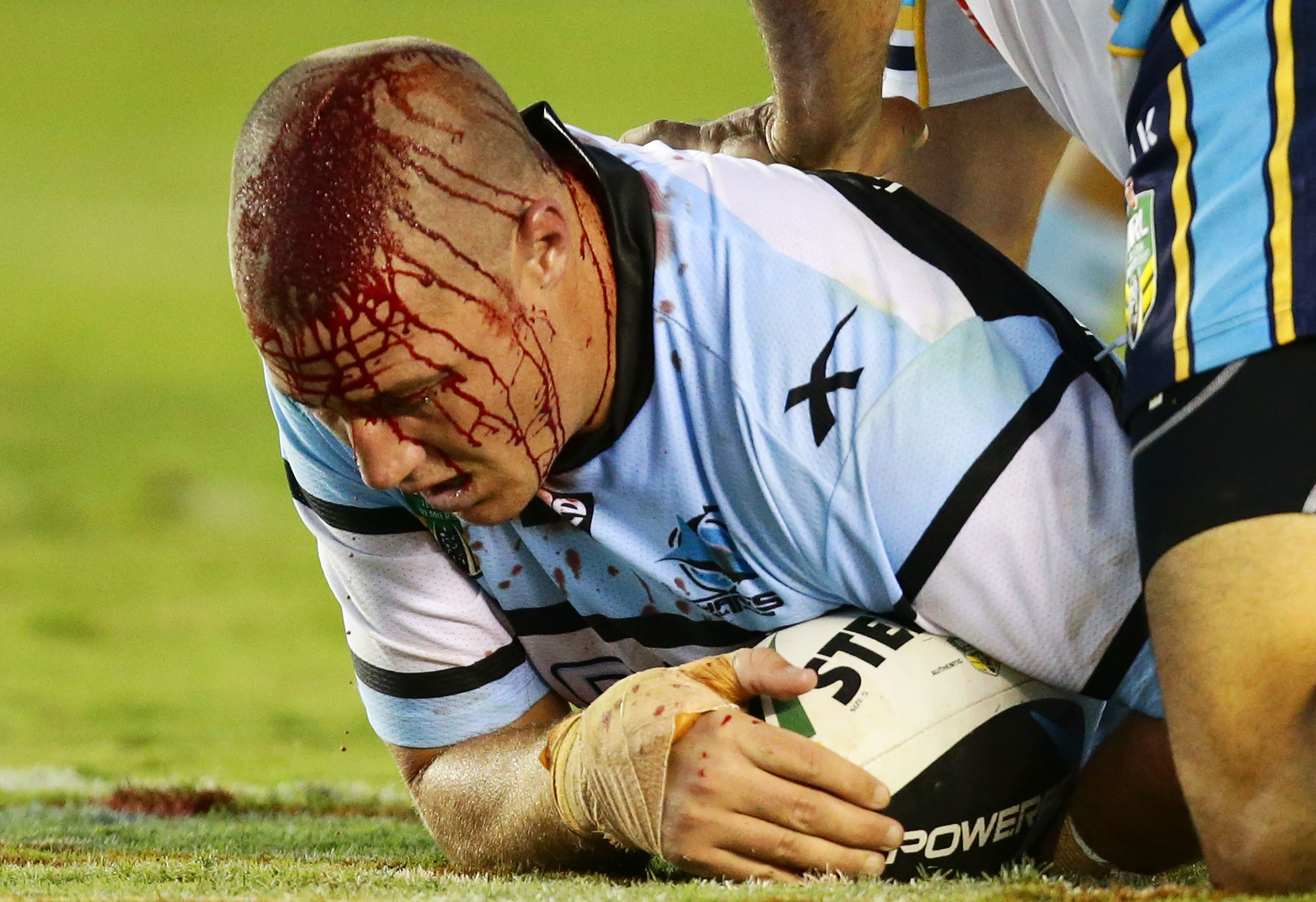 Rugby Verletzungen