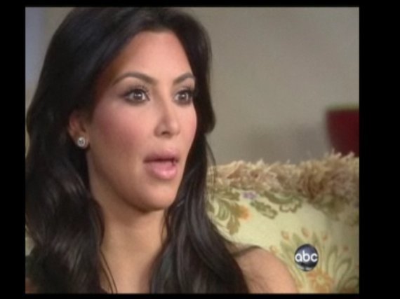 Kim Kardashian Botox
