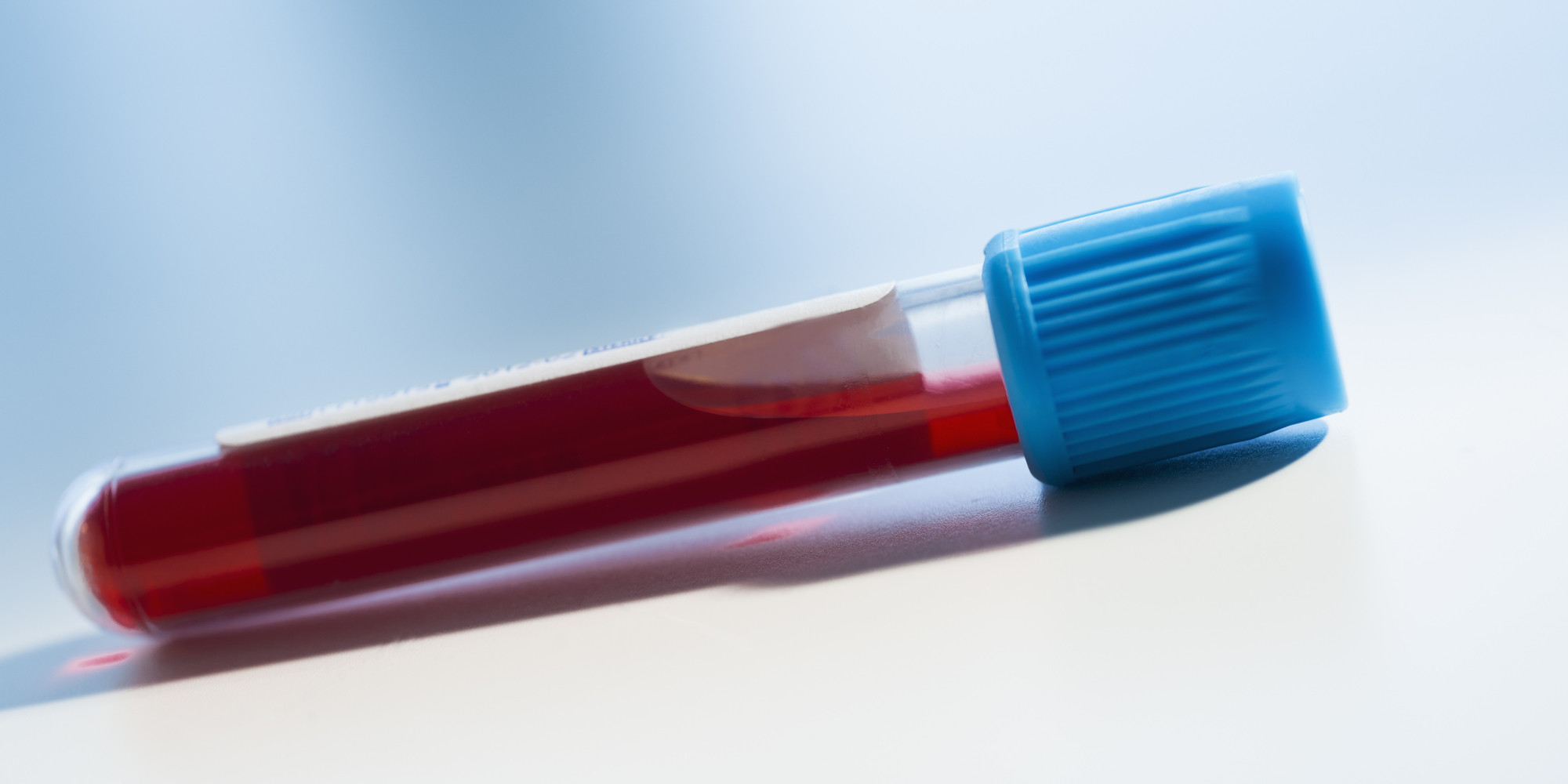 Covering the Blood Before Us (Acharei Mot, Leviticus 1611830