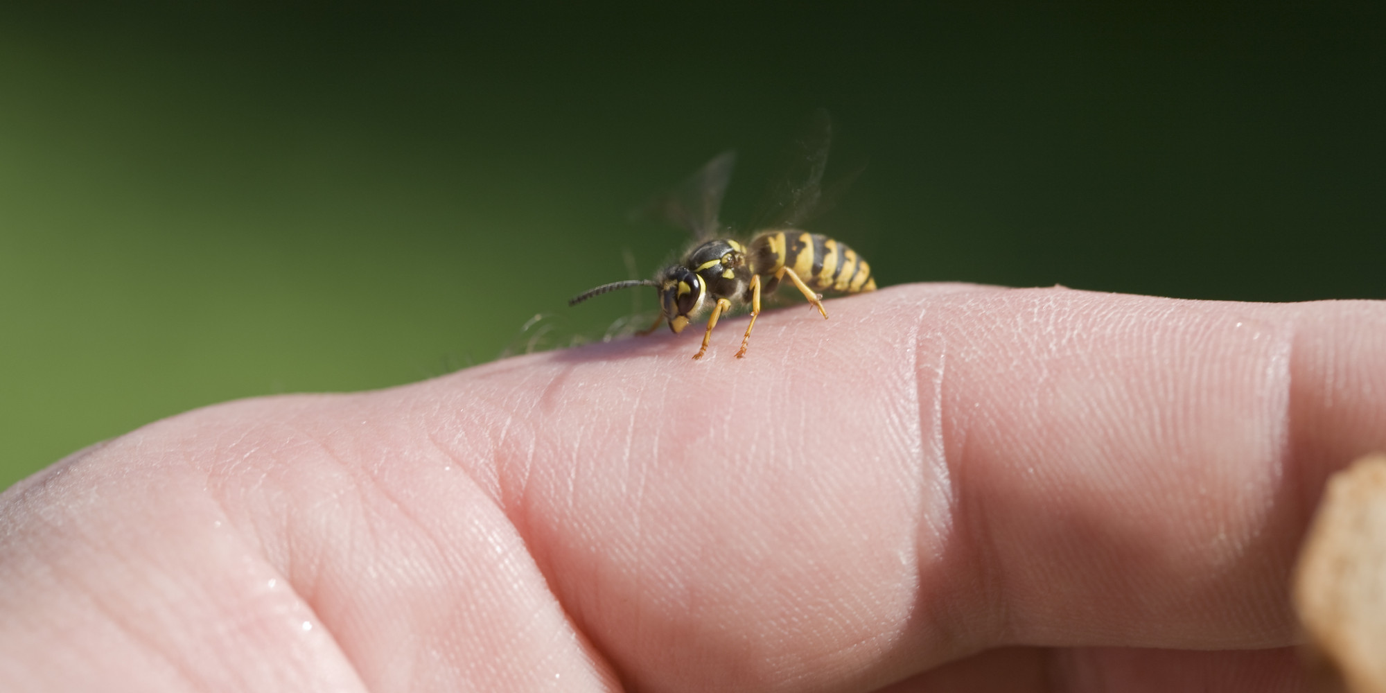 The best bee sting remedies. - Slate Magazine